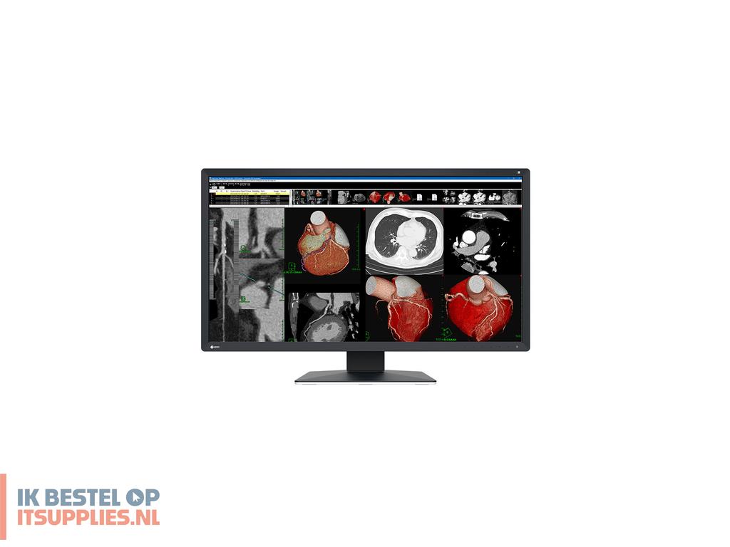 0541551-eizo_radiforce_mx317w_computer_monitor_77-5_cm_305_4096_x_2160_pixels_4k_dci_lcd_zwart